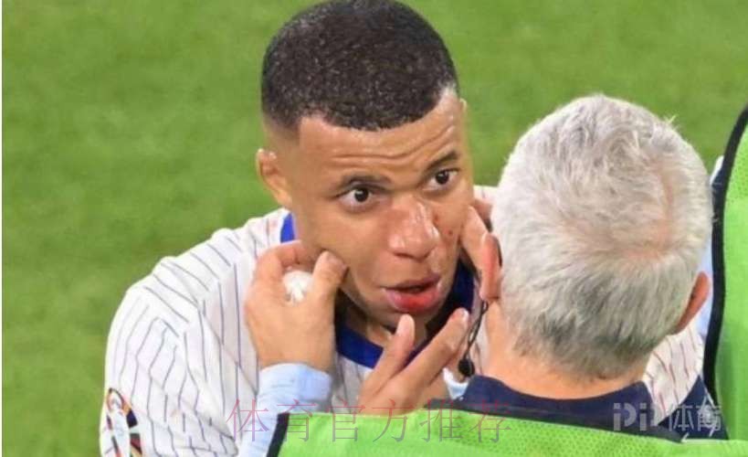 皇马担心姆巴佩鼻子骨折影响亮相 希望他接受手术